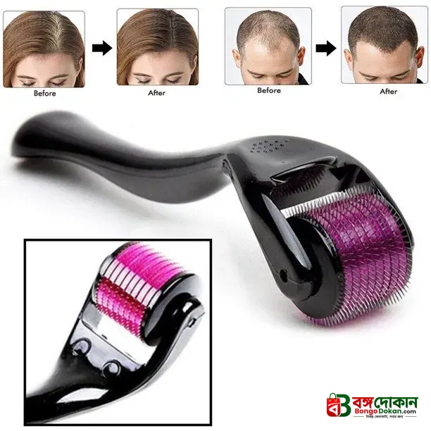 540 Micro Needle Derma Roller Therapy Skin ( 0.50mm) - বাংলাদেশে সেরা দাম ও লাইফস্টাইল কালেকশন - গ্যালারি